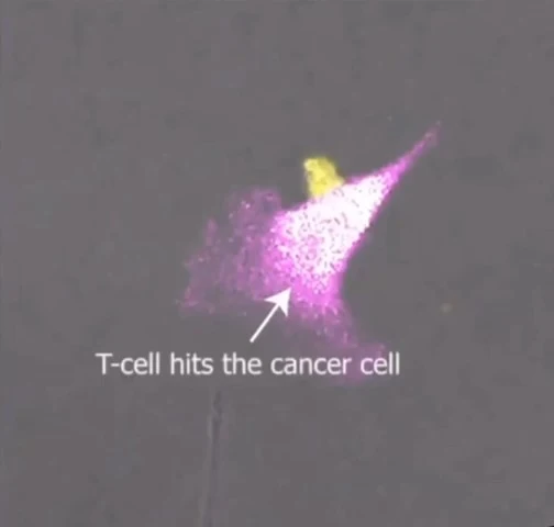 T-cell fights a Cancer cell